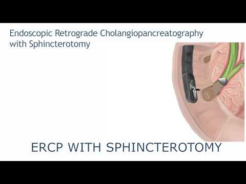 ERCP with sphincterotomy