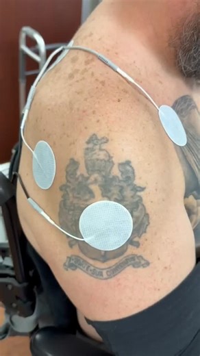 Matt Spaid on Instagram: "Care package in action. This is Ted Hartwell using the H-Wave device we sent him through Operation Antifragile. H-Wave is different from a standard TENS unit. It’s designed to improve circulation, support nerve signaling, and can be especially helpful for managing phantom pain and long-term recovery. This is what your support makes possible. Thank you to everyone who has donated and continues to stand behind this mission. If you’d like to support Ted’s recovery and help