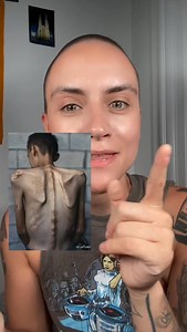 19K views · 2.2K reactions | If any of you have contacts who can evacuate him, text his mom. Donate to @ahmed_alkhodary_ in my bio. . . . . #gaza #palestine #celiac #disability #israel | Chelsea Hart | Facebook