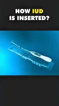 What Actually Happens When Doctor Puts IUD Inside? (3D Animation)