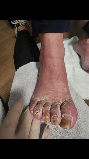 Gift yourself to a Medical Grade Footcare Service at Treat Your Feet Medical & Mobile Foot Spa, LLC 👣💚🎁 #treatyourfeet #shepedi #medicalpedicurenashville #diabeticpedicure #mobilepodiatryasst