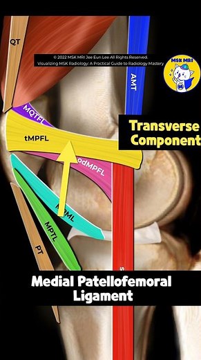 (Fig 4-A.01) Anatomy of the Medial Patellar Retinacular Complex/ Part 1