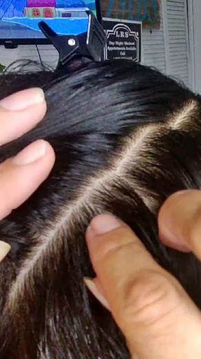 10K reactions · 28 shares | Shop my lice removal and lice prevention...