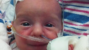 Mothers of children with heart defects form a special bond