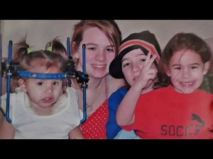 Mind-Eye Helps 14-Year-Old Overcome Limitations of Rare "Klippel-Feil" Syndrome