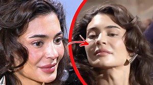 5 Botched Celebrities You Won't Recognize In 2024 | Beyond The Screen