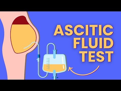Ascitic Fluid Test - Peritoneal Fluid Collection, Examination & Analysis Explained