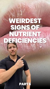 2.5M views · 12K reactions | Comment “FISHY” and I’ll send you my favorite omega-3 fatty acid supplement! Have you checked these deficiencies? | Dr. Jaban Moore | Facebook