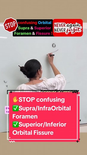 Now you are set!!! 💃🏻 ✅ Supraorbital foramen ✅ Superior orbital fissure ✅ Infraorbital foramen ✅ Inferior orbital fissure #EngagedLearning #educationunleashed #drbenaduce #wittyanatomy #humananatomy #anatomy101 #humanbody #iloveanatomy #nursing #prepa #doctor #prept #viva #greysanatomyaddict #prenursing #mmbs #collegestudents #nursingstudent #ptstudent #medicalstudent #viraltiktok