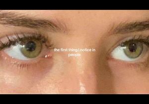 Exploring Eye Colors: Beauty and Diversity