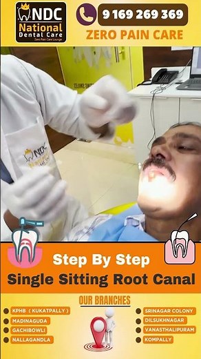 Step By Step ROOT CANAL Treatment || Best Dental Hospital In Hyderabad || NDC