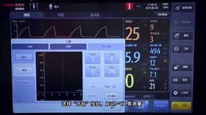 迈瑞SV300呼吸机操作视频——③特殊通气功能