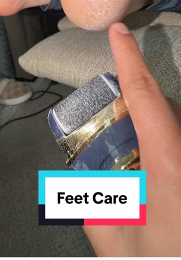 The Ultimate Electric Callus Remover for Smooth Feet