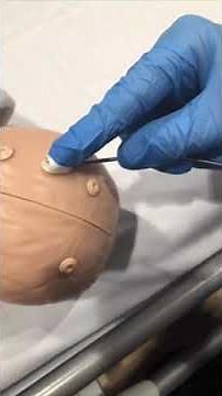 Fetal Scalp Electrode Application.