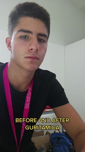 Transform Your Body: Before and After Gurtamica