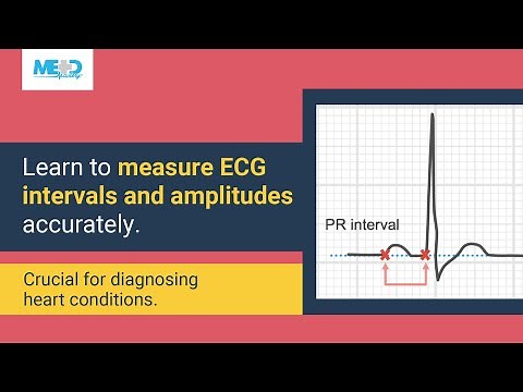 Interval and amplitude measurements