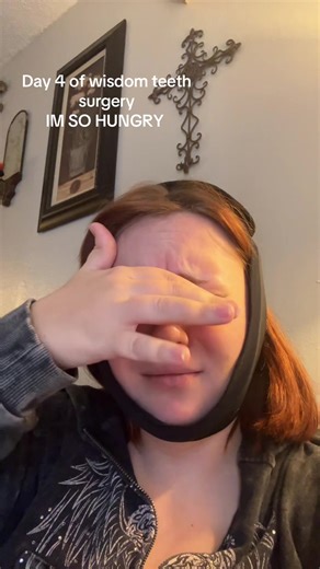 Wisdom Teeth Removal: Day 4 Recovery Journey