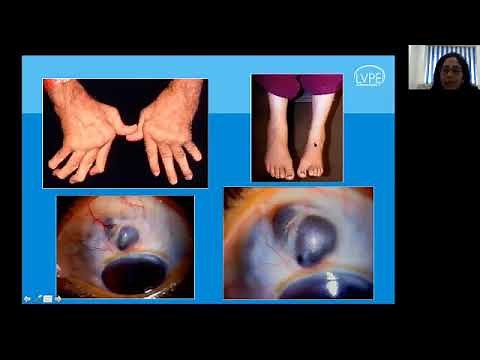 Scleritis: Diagnosis and Management