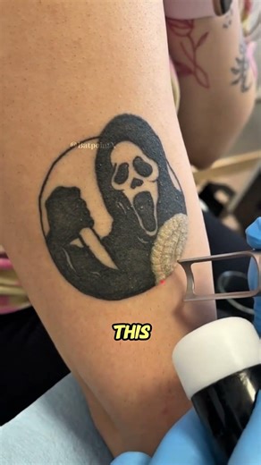 How Laser Actually Removes Tattoos 😳 #short #viralvideo