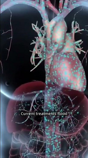 Scientists developed Magnet-guided microbots that deliver stroke-busting drugs right to the clot