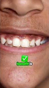 Is fluoride good or bad? Let’s look at the facts.