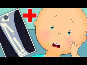 L’os cassé de Caillou | Les Nouvelles Aventures de Caillou | Caillou en Français