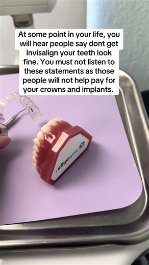 Benefits of Invisalign for Your Dental Health