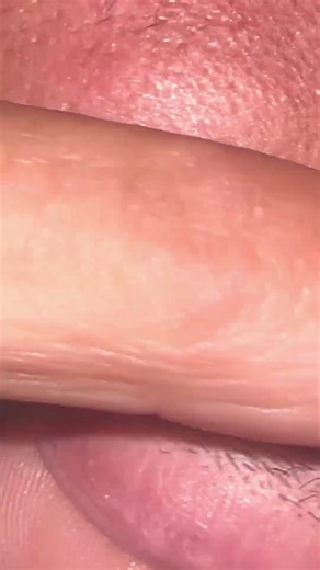 #relax #tweezer #pimple #thebarbersarms #satisfying #acmr #amsr #sounds #lashes #skincare 🙈🤏🏼🤏🏼