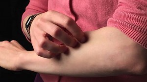 Wat is jeuk en hoe kom je er vanaf?