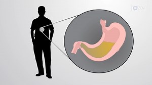 Video: Acids, Bases and Neutralization Reactions