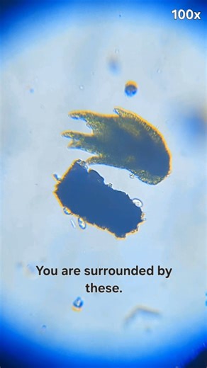 Ciliates Swarming Debris (100x) #microscope