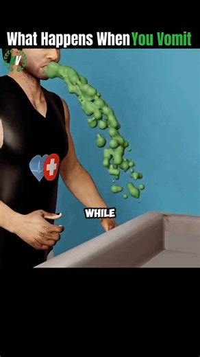 Health.Dailywellness.Selfcarespot on Instagram: "What Happens When You Vomit ... Vomiting, also known as emesis or "throwing up," is the forceful ejection of stomach contents through the mouth. It's a complex reflex action controlled by the brain and is often a protective mechanism to rid the body of harmful substances. ​Here's a breakdown of what happens when you vomit: ​1. The Trigger and the Brain's Role ​The Emetic Center: The process is coordinated by the vomiting center in your brain. This