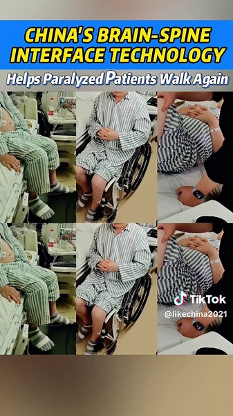 China's Brain-Spine Interface Technology Restores Movement