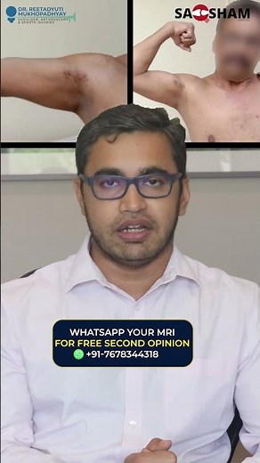 Biceps Tenotomy Explained | Shoulder Pain Relief with Dr. Reeta"