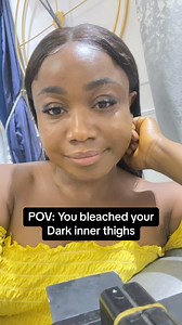 Stop bleaching your dark inner thighs | Dati.Remedies