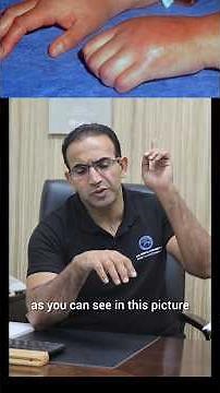 Stiff hand & wrist after injury or surgery? 🤲 Try these gentle CRPS exercises