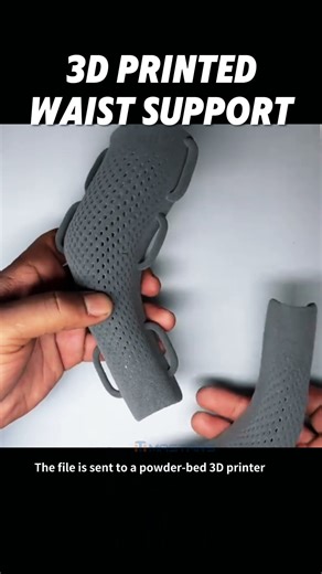 Prosthetic and orthotic fabrication: how can 3D printing create custom wrist supports