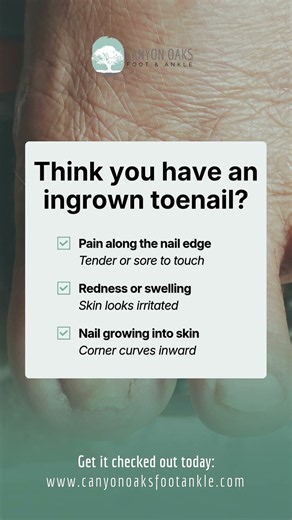 Think You Have an Ingrown Toenail? Look for These Signs | Visalia Podiatrist