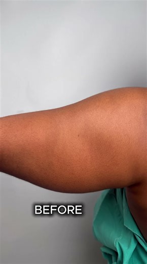 🔥 No more hiding those arms — it’s time to flaunt them!