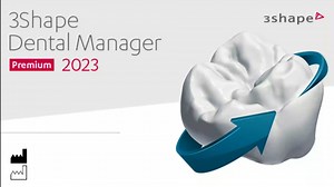 インレーの設計方法