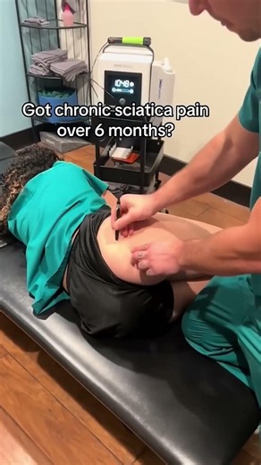 This is How You Release Trapped Sciatic Nerves!! #sciatica #adhesion #treatment #shockwave