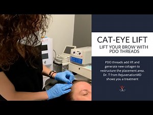 Non-Surgical Brow and Eye lift with PDO Threads