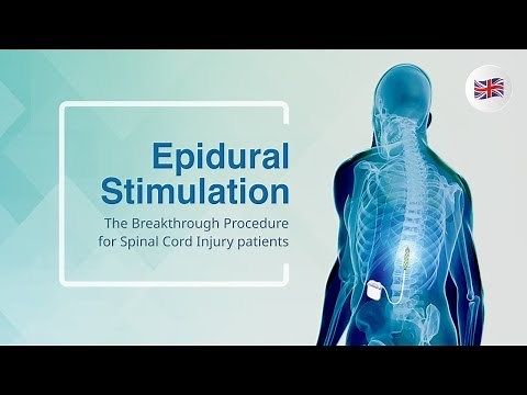 Epidural Stimulation: The Breakthrough Procedure for Spinal Cord Injury patients