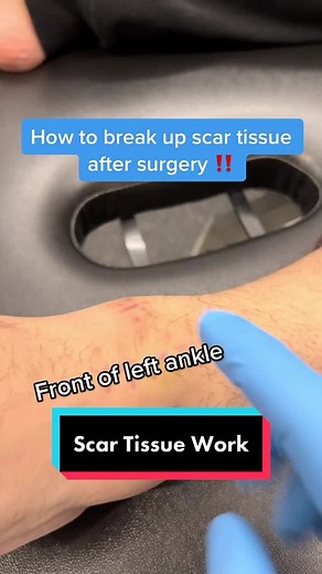 Physio Mike on TikTok