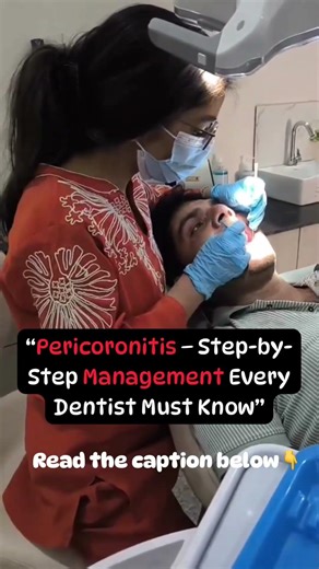 “Wisdom Tooth Infection? Step-by-Step Pericoronitis Management” #trendingreels #doctor #dentist