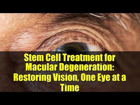 Stem Cell Treatment for Macular Degeneration: Restoring Vision, One Eye at a Time
