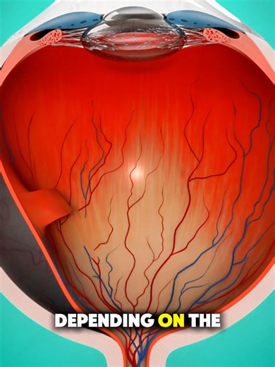 How Vitrectomy is Done? (3D Animation) #how #vitrectomy #eyes #vision #3danimation