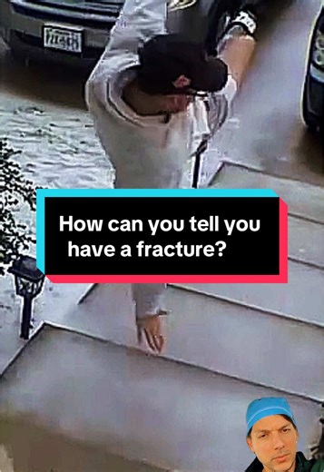 Signs of a Fracture After a Slip and Fall