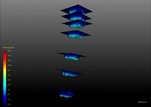 CSF velocities measured by 4D Flow MRI imaging in a 3D printed in vitro model of the upper cervical spine. | Osteopathic World - Roberto Pagliaro
