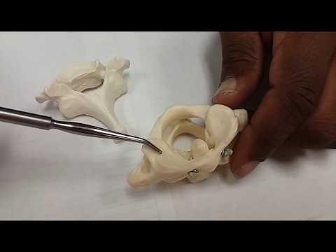 C1, C2, Atlas, Axis + Dens